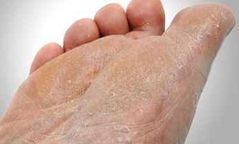 Μονοπάτια μετάδοσης μυκήτων ποδιών